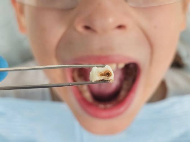 Emergency Dentist for Kids